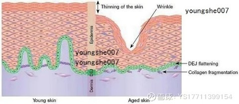 乙酰基三肽-30瓜氨酸 Acetyl Tripeptide-30 Citrulline淡化妊娠纹保护结缔组织不降解，帮助重建ECM（细胞外基质）